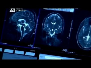 Тест на любовь. фМРТ. Нейровизуализация.